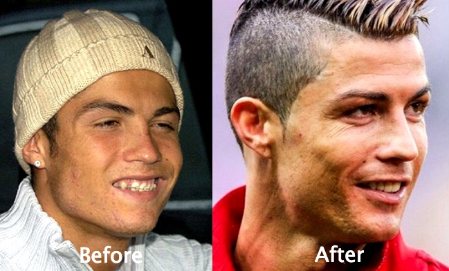Cristiano Ronaldo: Το πριν και το μετά τις πλαστικές του παίκτη των 93 εκατομμυρίων Ο Ronaldo άλλαξε, αλλά οι φωτογραφίες μένουν… - Φωτογραφία 3