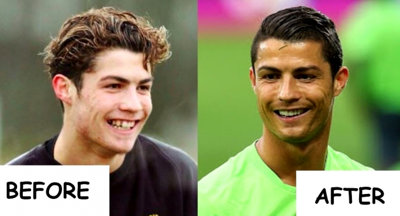 Cristiano Ronaldo: Το πριν και το μετά τις πλαστικές του παίκτη των 93 εκατομμυρίων Ο Ronaldo άλλαξε, αλλά οι φωτογραφίες μένουν… - Φωτογραφία 4