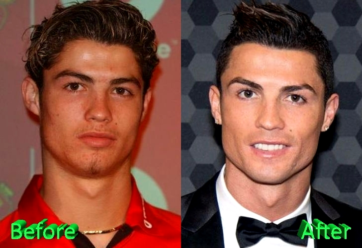 Cristiano Ronaldo: Το πριν και το μετά τις πλαστικές του παίκτη των 93 εκατομμυρίων Ο Ronaldo άλλαξε, αλλά οι φωτογραφίες μένουν… - Φωτογραφία 5