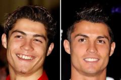 Cristiano Ronaldo: Το πριν και το μετά τις πλαστικές του παίκτη των 93 εκατομμυρίων Ο Ronaldo άλλαξε, αλλά οι φωτογραφίες μένουν…