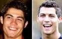 Cristiano Ronaldo: Το πριν και το μετά τις πλαστικές του παίκτη των 93 εκατομμυρίων Ο Ronaldo άλλαξε, αλλά οι φωτογραφίες μένουν… - Φωτογραφία 6