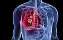 Ο «οδικός χάρτης» ενός ασθενούς με καρκίνο του πνεύμονα