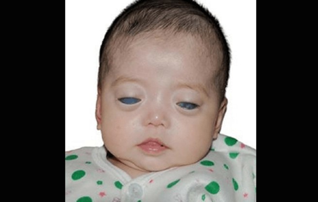 Κανείς δεν ήθελε αυτό το μωρό με τα Ασημένια Διαπεραστικά Μάτια - Μια φωτογραφία όμως άλλαξε τα πάντα! - Φωτογραφία 1