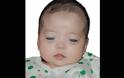 Κανείς δεν ήθελε αυτό το μωρό με τα Ασημένια Διαπεραστικά Μάτια - Μια φωτογραφία όμως άλλαξε τα πάντα!
