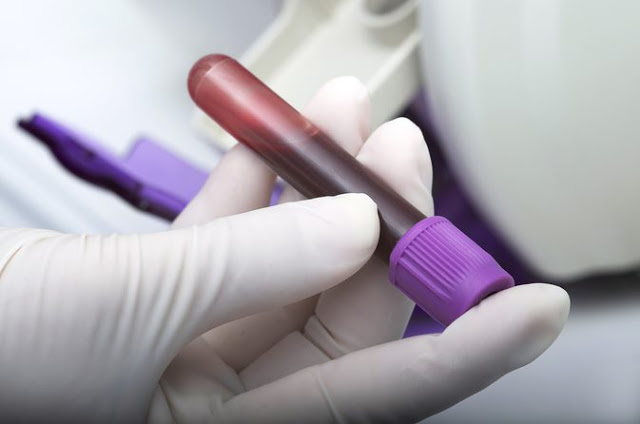 Οκτώ είδη καρκίνου ταυτόχρονα μπορεί να ανιχνεύει το τεστ αίματος που ανέπτυξαν επιστήμονες με τη συμμετοχή Έλληνα ογκολόγου! - Φωτογραφία 1