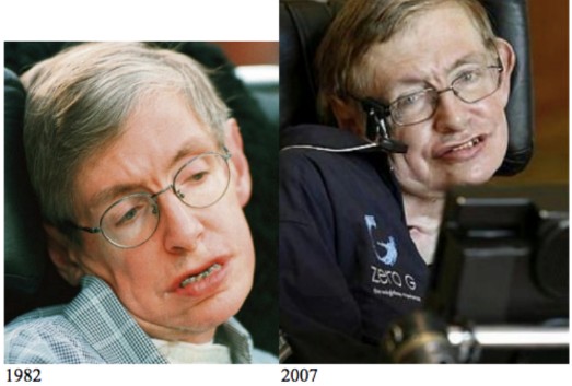 Περίεργη θεωρία συνωμοσίας: Ο Stephen Hawking είναι νεκρός κι έχει αντικατασταθεί από σωσία! [video] - Φωτογραφία 2