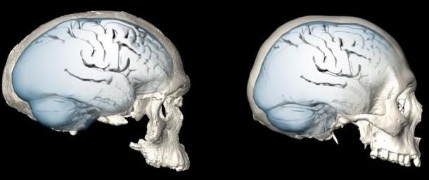 Το σφαιρικό σχήμα του ανθρώπινου εγκεφάλου εξελίχθηκε σταδιακά - Φωτογραφία 1