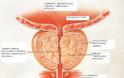 Ποιοι κινδυνεύουν από καρκίνο του προστάτη; - Φωτογραφία 2