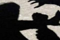 Λαμία: Ο κλέφτης του δάγκωσε τα χέρια για να ξεφύγει! [photos]