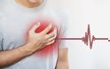 Τι μπορεί να προκαλέσει την καρδιακή αρρυθμία;