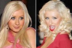 Οι σταρ που έκαναν αλλαγή μύτης! Δείτε το πριν και το μετά [φωτο]