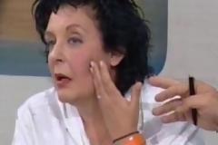 ΔΕΙΤΕ: Τα σημάδια στο πρόσωπο της Λιάνας!