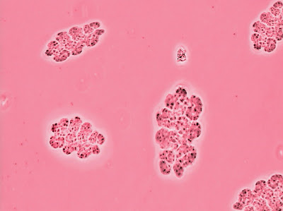 Ροζ λίμνη βαμμένη από βακτήρια - Φωτογραφία 4