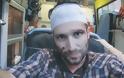 Άγριος ξυλοδαρμός ρεπόρτερ της Jerusalem Post στην Αθήνα, ο οποίος έκανε ρεπορτάζ για την 