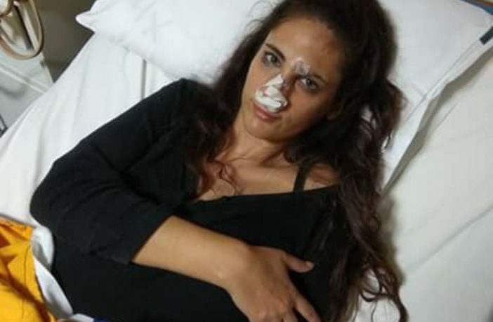 Ναστάζια το «κορίτσι» του Θέμου: Σοκάρουν οι φωτογραφίες του γνωστού μοντέλου από το νοσοκομείο  #survivorGR v #SurvivorPanoramaGR #shoppingstar #Dwts6 #MasterChefGR - Φωτογραφία 1