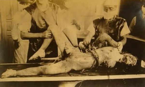 Μονάδα 731: Το πιο αποτρόπαιο έγκλημα στην ιστορία του ανθρώπινου είδους - Φωτογραφία 2