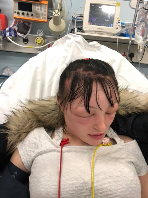 Οι φωτογραφίες γυναίκας που σόκαραν το Internet - Κατέληξε στο νοσοκομείο από βαφή μαλλιών - Φωτογραφία 3