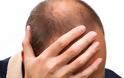 Γιατί κάποιοι άνδρες χάνουν πρόωρα τα μαλλιά τους;