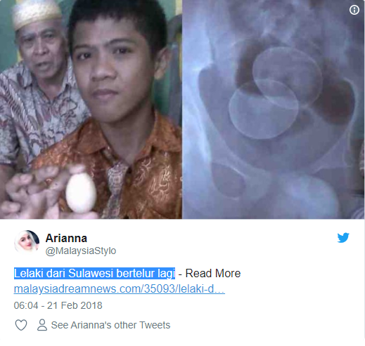 Ανεξήγητο φαινόμενο Οι επιστήμονες τρελάθηκαν: 14χρονος «γεννά» αυγά στην Ινδονησία - Φωτογραφία 3