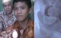 Ανεξήγητο φαινόμενο Οι επιστήμονες τρελάθηκαν: 14χρονος «γεννά» αυγά στην Ινδονησία
