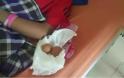 Ανεξήγητο φαινόμενο Οι επιστήμονες τρελάθηκαν: 14χρονος «γεννά» αυγά στην Ινδονησία - Φωτογραφία 2