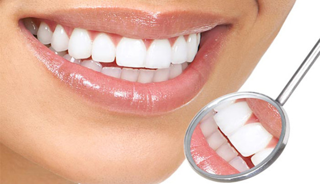 Λεύκανση δοντιών στο σπίτι: 10 εύκολα tips! - Φωτογραφία 1
