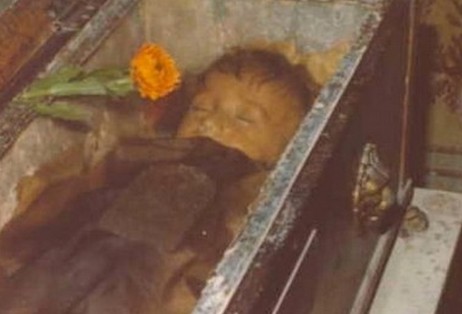 Αυτό το μικρό κοριτσάκι είναι νεκρό εδώ και 95 χρόνια - Όταν ξαφνικα άνοιξε τα μάτια της [photos] - Φωτογραφία 1
