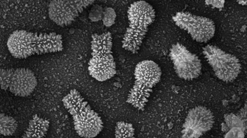 Ανακαλύφθηκαν δύο σπάνιοι γιγάντιοι ιοί με τα περισσότερα γονίδια για δημιουργία πρωτεϊνών - Φωτογραφία 1