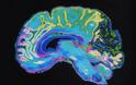 Γρίπη: Πώς επηρεάζει τη λειτουργία του εγκεφάλου - Φωτογραφία 2