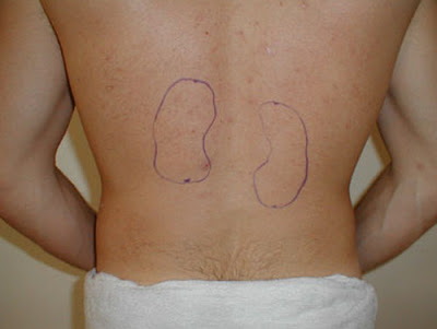 Ο πόνος στην πλάτη μπορεί να οφείλεται στους νεφρούς; Γνωρίζετε που βρίσκονται οι νεφροί; Ποια η θέση των νεφρών - Φωτογραφία 4