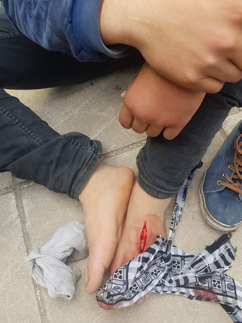 Καταγγελία: Λιμενικοί τραυμάτισαν ανήλικο στην Πάτρα - Φωτογραφία 4