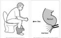 Μήπως κάθεστε με λάθος τρόπο στην τουαλέτα; Δείτε ποιος είναι ο σωστός και αποφύγετε ποικίλα προβλήματα - Φωτογραφία 2
