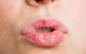 7 τρόποι να απαλλαγείτε από τα σκασμένα χείλη - Φωτογραφία 1