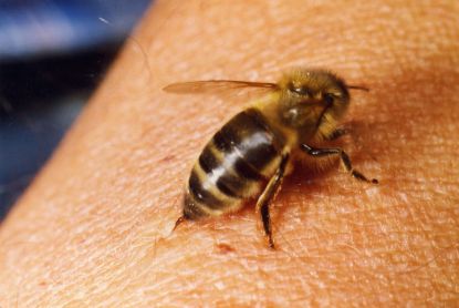 Τι είναι η μελισσοθεραπεία και που χρησιμοποιείτε; Είναι κατάλληλη για εσάς; - Φωτογραφία 3