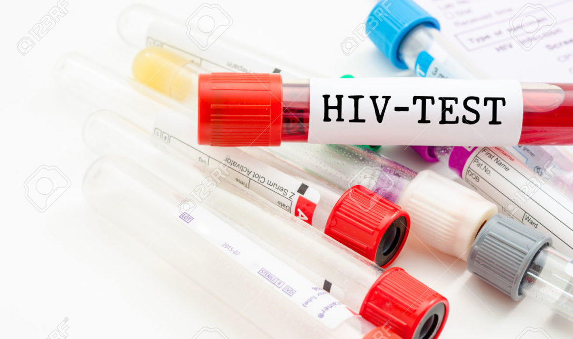 Το rapid test είναι εξαιρετικά σημαντικό για την έγκαιρη ανίχνευση του HIV - Φωτογραφία 1