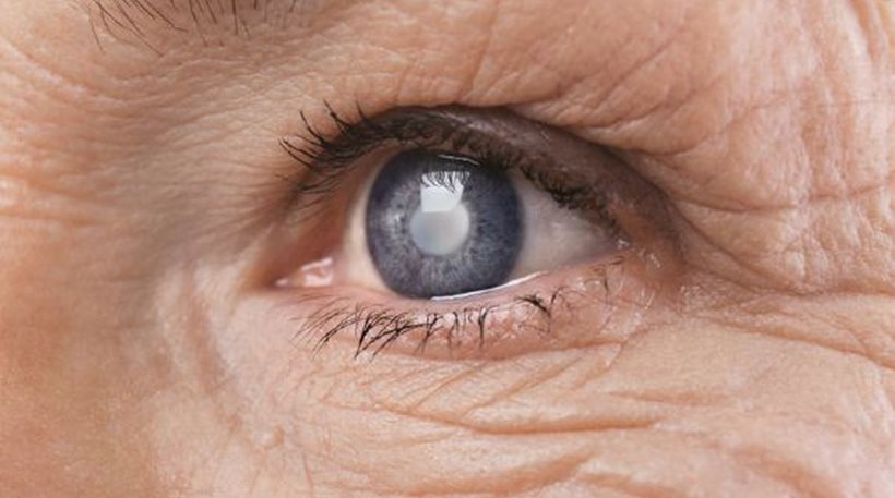 Θεραπεία βλαστοκυττάρων αποκατέστησε την όραση ηλικιωμένων ένα βήμα πριν την τύφλωση - Φωτογραφία 1