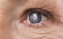 Θεραπεία βλαστοκυττάρων αποκατέστησε την όραση ηλικιωμένων ένα βήμα πριν την τύφλωση