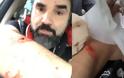 Επίθεση στον δημοσιογράφο Νάσο Γουμενίδη: Οι δράστες τον χτυπούσαν με σφυρί! Video