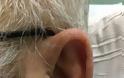 Από τα αυτιά φαίνεται ο κίνδυνος του … εγκεφαλικού! [ΕΙΚΟΝΕΣ] - Φωτογραφία 2