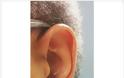 Από τα αυτιά φαίνεται ο κίνδυνος του … εγκεφαλικού! [ΕΙΚΟΝΕΣ] - Φωτογραφία 4