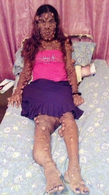 Γέννησε και μετά το σώμα της γέμισε με χιλιάδες όγκους – Σοκάρουν οι εικόνες… [photos+video] - Φωτογραφία 2