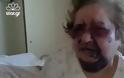 Άγριος ξυλοδαρμός 83χρονης για να της αρπάξουν τη σύνταξη – ΕΙΚΟΝΕΣ ΣΟΚ (VIDEO)