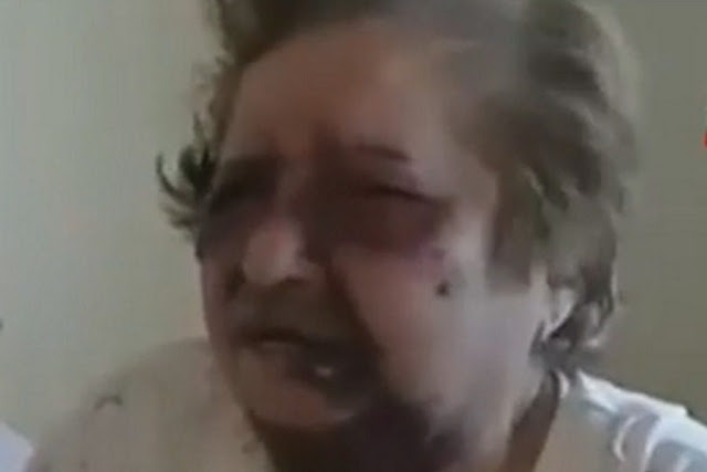 Σοκ στη Σαλαμίνα! Ληστές «σακάτεψαν» στο ξύλο 83χρονη για να της πάρουν τη σύνταξη [Βίντεο] - Φωτογραφία 1