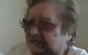 Σοκ στη Σαλαμίνα! Ληστές «σακάτεψαν» στο ξύλο 83χρονη για να της πάρουν τη σύνταξη [Βίντεο]