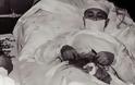 Μπράβο για τη δύναμη της ψυχής σου: Ο σοβιετικός γιατρός που αναγκάστηκε να χειρουργήσει μόνος του τον εαυτό του [photos+video] - Φωτογραφία 1