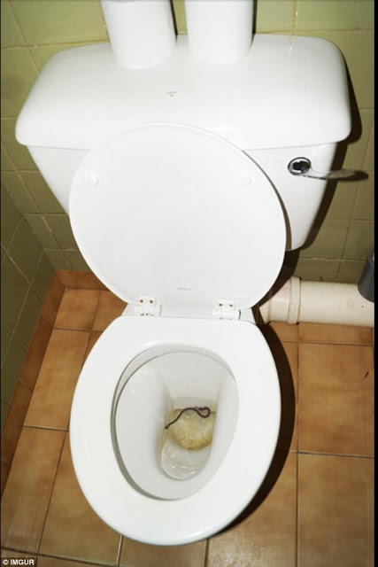 Δεν παίζει αυτά να συμβαίνουν: Σοκαριστικές φωτογραφίες δείχνουν τα τρομακτικά ευρήματα ανθρώπων στις τουαλέτε - Φωτογραφία 9