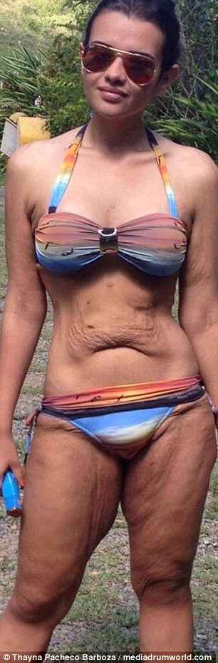 Η απίστευτη μεταμόρφωση μίας Βραζιλιάνας που έγινε viral -Εχασε 80 κιλά, απέκτησε σώμα μοντέλου - Φωτογραφία 1