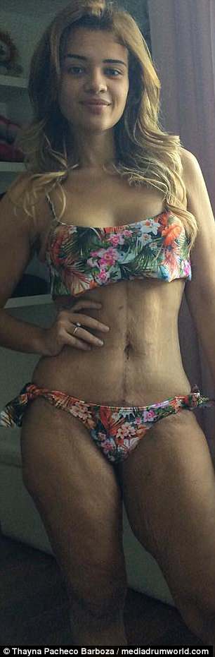 Η απίστευτη μεταμόρφωση μίας Βραζιλιάνας που έγινε viral -Εχασε 80 κιλά, απέκτησε σώμα μοντέλου - Φωτογραφία 6