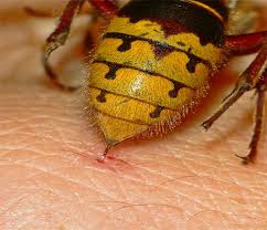Πρώτες βοήθειες για τσίμπημα μέλισσας, σφήκας ή σφίγγας ή σφήγκας. Πώς να αφαιρέσετε το κεντρί. Αντιμετώπιση αλλεργικής αντίδρασης - Φωτογραφία 1