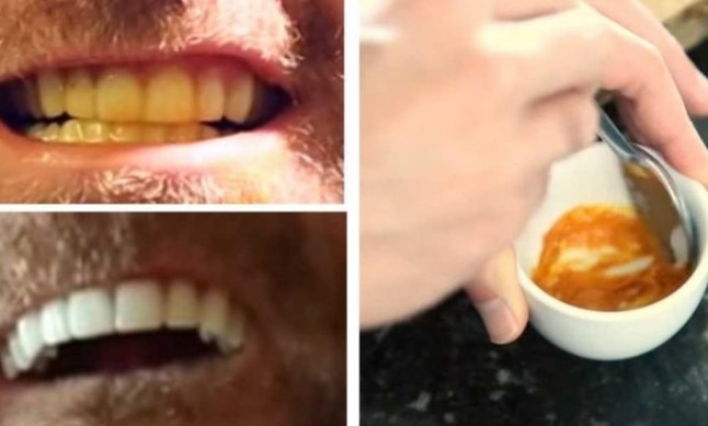 Καταπληκτικό - Αυτός ο άνδρας μας δείχνει πως να λευκάνουμε μόνοι τα δόντια μας - Θα το κάνετε σίγουρα [photos] - Φωτογραφία 1